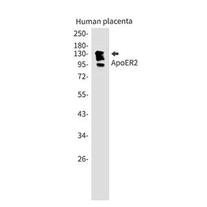 ApoER2兔单抗,ApoER2 Rabbit Monoclonal Antibody