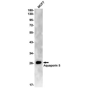 Aquaporin 5兔单抗,Aquaporin 5 Rabbit Monoclonal Antibody