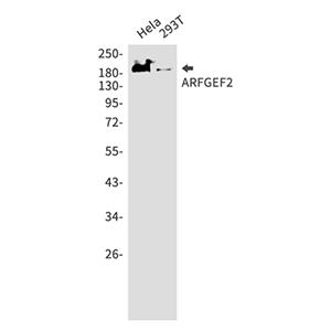 ARFGEF2兔单抗,ARFGEF2 Rabbit Monoclonal Antibody