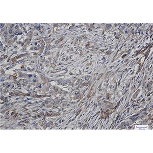 ATG4C兔单抗,ATG4C Rabbit Monoclonal Antibody