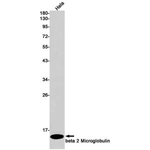 beta 2 Microglobulin兔单抗,beta 2 Microglobulin Rabbit Monoclonal Antibody