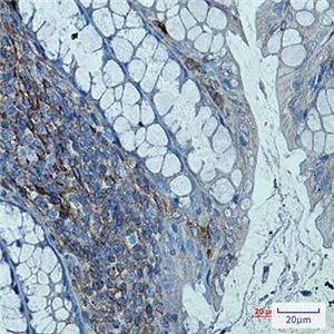 beta 2 Microglobulin兔单抗,beta 2 Microglobulin Rabbit Monoclonal Antibody