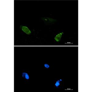 BIN1兔单抗,BIN1 Rabbit Monoclonal Antibody