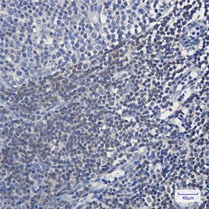 BIN1兔单抗,BIN1 Rabbit Monoclonal Antibody