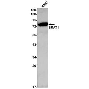 BRAT1兔单抗,BRAT1 Rabbit Monoclonal Antibody