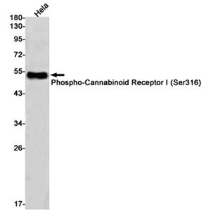 Phospho-Cannabinoid Receptor I (Ser316)兔单抗,Phospho-Cannabinoid Receptor I (Ser316) Rabbit Monoclonal Antibody