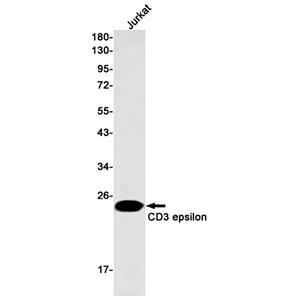 CD3 epsilon兔单抗,CD3 epsilon Rabbit Monoclonal Antibody