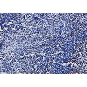 CD3 epsilon兔单抗,CD3 epsilon Rabbit Monoclonal Antibody