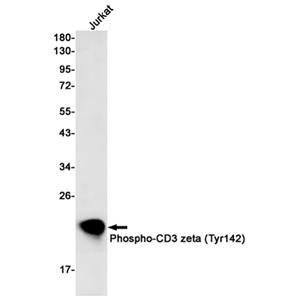 Phospho-CD3 zeta (Tyr142)兔单抗,Phospho-CD3 zeta (Tyr142) Rabbit Monoclonal Antibody
