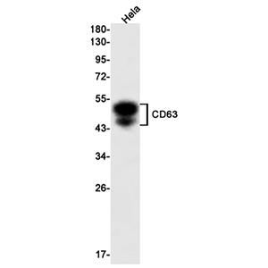 CD63兔单抗,CD63 Rabbit Monoclonal Antibody