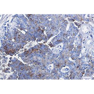 CD63兔单抗,CD63 Rabbit Monoclonal Antibody