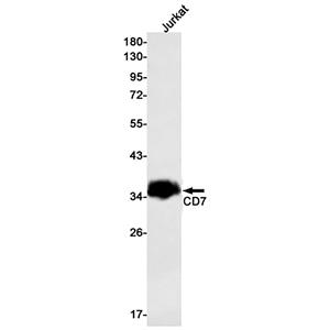 CD7兔单抗,CD7 Rabbit Monoclonal Antibody
