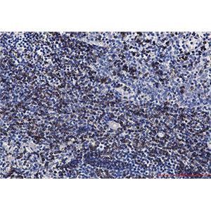 CD7兔单抗,CD7 Rabbit Monoclonal Antibody