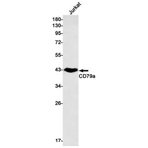 CD79a兔单抗,CD79a Rabbit Monoclonal Antibody