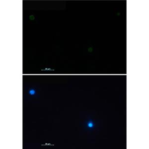 CD79a兔单抗,CD79a Rabbit Monoclonal Antibody