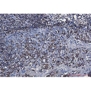 CD79a兔单抗,CD79a Rabbit Monoclonal Antibody