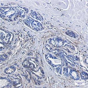 CD99兔单抗,CD99 Rabbit Monoclonal Antibody