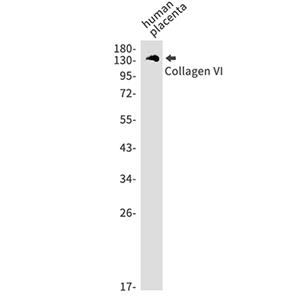 Collagen VI alpha 1兔单抗,Collagen VI alpha 1 Rabbit Monoclonal Antibody