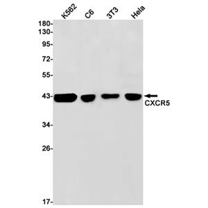 CXCR5兔单抗,CXCR5 Rabbit Monoclonal Antibody