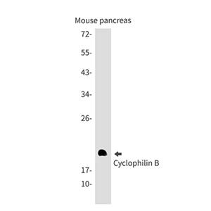 Cyclophilin B兔单抗,Cyclophilin B Rabbit Monoclonal Antibody