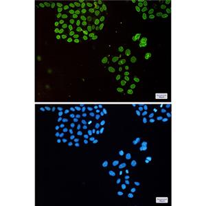 Emerin兔单抗,Emerin Rabbit Monoclonal Antibody