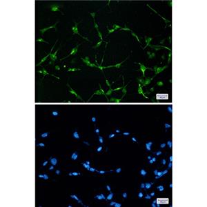 EWSR1兔单抗,EWSR1 Rabbit Monoclonal Antibody