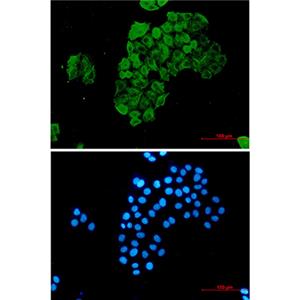 FKBP52兔单抗,FKBP52 Rabbit Monoclonal Antibody
