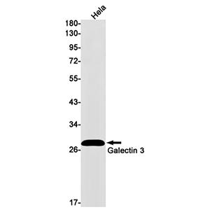 Galectin 3兔单抗,Galectin 3 Rabbit Monoclonal Antibody