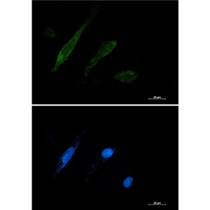 Galectin 3兔单抗,Galectin 3 Rabbit Monoclonal Antibody