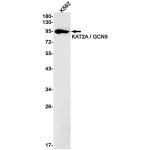 KAT2A兔单抗,KAT2A Rabbit Monoclonal Antibody