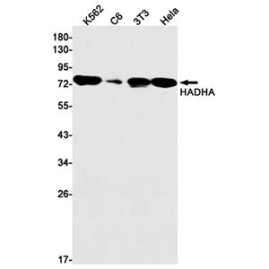 HADHA兔单抗,HADHA Rabbit Monoclonal Antibody