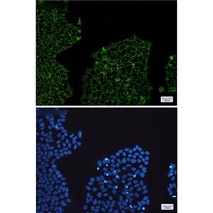 HADHA兔单抗,HADHA Rabbit Monoclonal Antibody