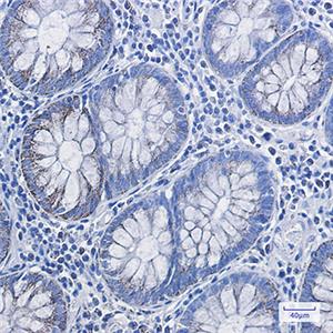 HADHA兔单抗,HADHA Rabbit Monoclonal Antibody