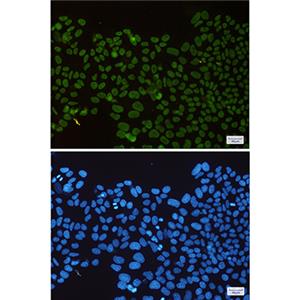 HDAC2兔单抗,HDAC2 Rabbit Monoclonal Antibody