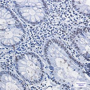 HDAC2兔单抗,HDAC2 Rabbit Monoclonal Antibody