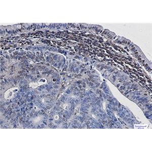 Phospho-Histone H3 (Ser28)兔单抗,Phospho-Histone H3 (Ser28) Rabbit Monoclonal Antibody