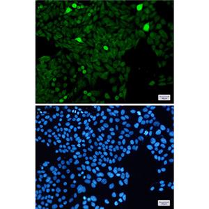 Phospho-Histone H3 (Ser28)兔单抗,Phospho-Histone H3 (Ser28) Rabbit Monoclonal Antibody