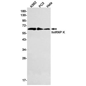 hnRNP K兔单抗,hnRNP K Rabbit Monoclonal Antibody