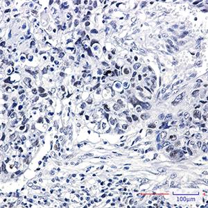 hnRNP K兔单抗,hnRNP K Rabbit Monoclonal Antibody