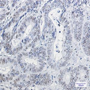 HP1 gamma兔单抗,HP1 gamma Rabbit Monoclonal Antibody