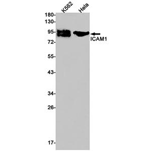 ICAM1兔单抗,ICAM1 Rabbit Monoclonal Antibody