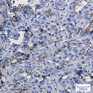 ICAM1兔单抗,ICAM1 Rabbit Monoclonal Antibody