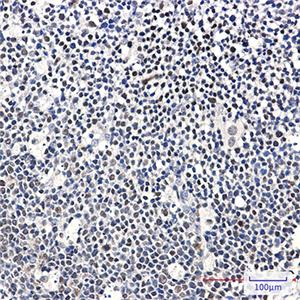 Ikaros兔单抗,Ikaros Rabbit Monoclonal Antibody