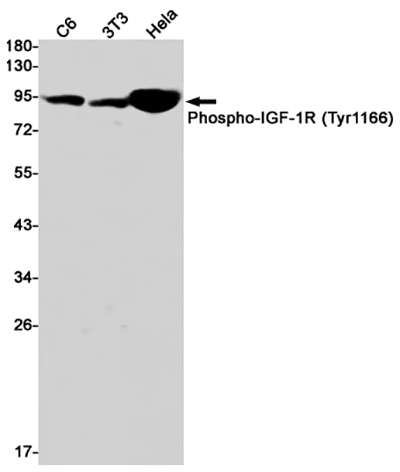 Phospho-IGF1 Receptor (Tyr1166)兔单抗,Phospho-IGF1 Receptor (Tyr1166) Rabbit Monoclonal Antibody