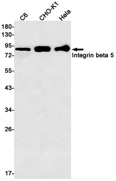 Integrin beta 5兔单抗,Integrin beta 5 Rabbit Monoclonal Antibody