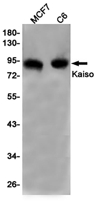 Kaiso兔单抗,Kaiso Rabbit Monoclonal Antibody