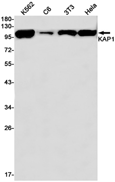 KAP1兔单抗,KAP1 Rabbit Monoclonal Antibody