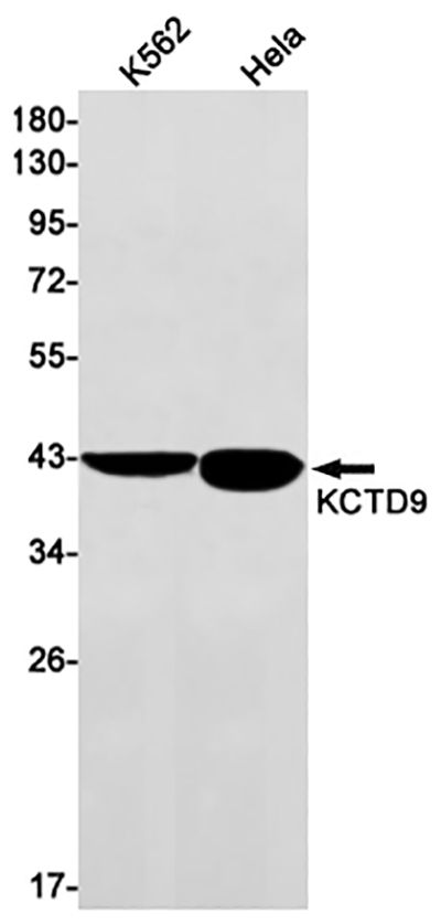KCTD9兔单抗,KCTD9 Rabbit Monoclonal Antibody