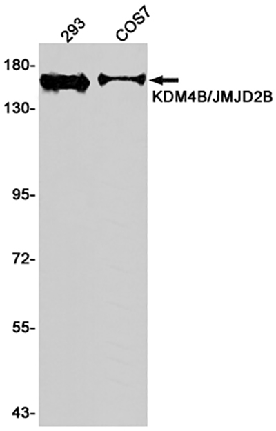 KDM4B兔单抗,KDM4B Rabbit Monoclonal Antibody