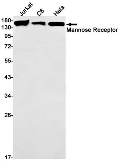 Mannose Receptor兔单抗,Mannose Receptor Rabbit Monoclonal Antibody
